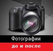 Photos before -after